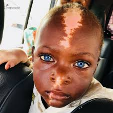 Shakul got to meet his sponsor, Matt, in Uganda and they are adorable  together. Despite the obstacles Shakul has faced throughout his life