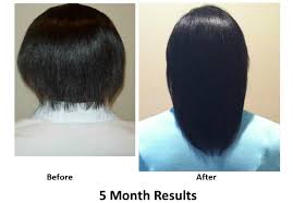 Make Hair Grow Old Fashioned Hair Growth Formula Make Hair Grow Hair Growth Formula Vitamins For Hair Growth
