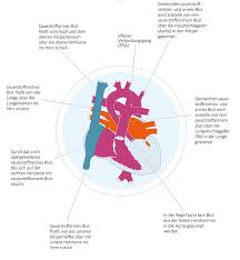 Case discussion aortopulmonary window , (partial truncus arteriosus or aortopulmonary septal defect ) is a rare congenital conotruncal cardiac anomaly with communication between the ascending aorta & the main or right pulmonary artery. Hypoplastisches Linksherzsyndrom Hlhs Kinderherzen