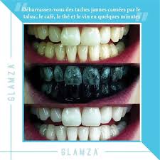 Où acheter du charbon végétal pour blanchir les dents ? Glamza Poudre De Blanchiment Dentaire Au Charbon Actif Achat Prix Fnac