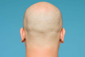 That said, you don't go bald all of a sudden, and that's the good news, as it were. The Bald And The Beautiful Why Do Men Still Fear Hair Loss London Evening Standard Evening Standard