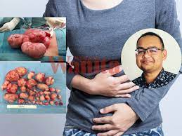 Penyakit yang diderita kaum wanita pada waktu haid, sesudah bersalin, dan sebagainya;. Perut Buncit Senggugut Teruk Kerap Terkencing Susah Mengandung Simptom Wanita Mungkin Ada Fibroid Mingguan Wanita