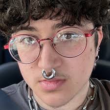 Fundraiser by Alex Van Dyke : Alex's Surgery: Beat the Insurance Clock