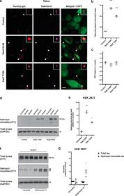 Logo, tin tức hình ảnh mới nhất luôn được cập nhật liên tục, chủ đề logo : Galectin 8 Mediated Selective Autophagy Protects Against Seeded Tau Aggregation Journal Of Biological Chemistry