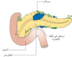 We did not find results for: File Diagram Showing Pancreatic Cancer In The Lymph Nodes N Staging Cruk 178 Ar Svg Wikimedia Commons