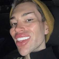 27 yo David Kosir has made the news recently, who began with  #medicalaesthetics in 2019, going for an exaggerated Ken doll look, only to  discover recently he didn't like it and dissolving