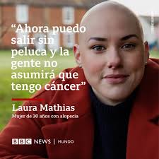 Laura Mathias sufre alopecia desde los 12 años. Por casi dos décadas  escondió su condición bajo una peluca, pero la pandemia, y ahora el  escándalo protagonizado por Will Smith y Chris Rock