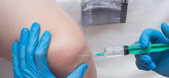 Let our urgent care experts help you. Ultrasound Joint Injections American Urgent Care Walk In Clinics