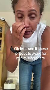 Jenny Eden Scar Salve