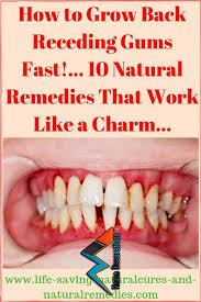 Some things you can do at home are to brush your teeth twice daily with fluoride toothpaste, floss after meals, and use antiseptic mouthwash. How To Reverse Gum Disease At Home Arxiusarquitectura