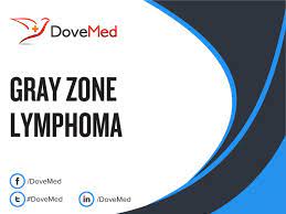 Gray zone lymphoma is an infrequently occurring lymphoma that is generally seen in teens and young adults (average age around 30 years). Gray Zone Lymphoma