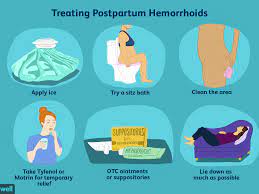 Hemorrhoids After Giving Birth At Home Treatments