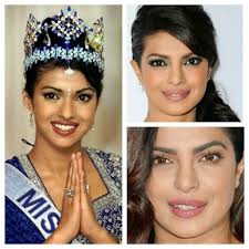 Priyanka Chopra Before After Nose Job Upper Lip Injection Contact Lenses She Was Miss World 2000 Before Plustic Suge Nose Job Lip Injections Upper Lip