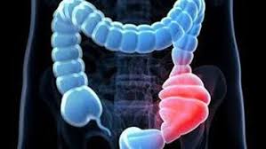 Image result for Encopresis