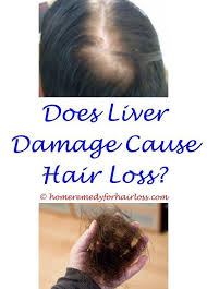 Redness, pain or peeling of palms and soles. Pin On Hair Loss Info