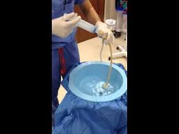 Image result for Bladder Irrigation