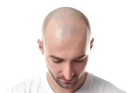 Check spelling or type a new query. The 1mm Haircut Grade Number Length Clipper With Pics Ready Sleek