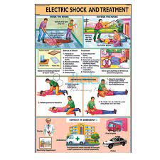 Plastic or laminated paper electric shock treatment poster with. Electric Shock Treatment Chart Pdf Free Download Chart Walls