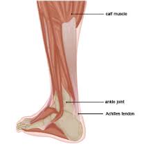 Your achilles tendon can develop tendonitis. Achilles Tendonitis Treatment Pain Spa Bristol Uk