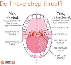 Is It Strep Throat Or Not Good Diagram Explaining A Viral Infection Vs A Bacterial Infection Sick Remedies Health Resources Medical