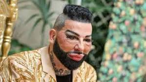 Speech and Language Prognosis in ASD by Dr Puja Grover Kapoor| Paediatric  Neurologist