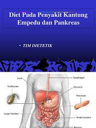 Pastikan setiap menu makanan untuk penderita diabetes setiap hari mengandung nutrisi seimbang seperti serat, protein, karbohidrat, dan berbagai mineral serta vitamin lainnya. Diet Kantung Empedu Dan Pankreas Pdf