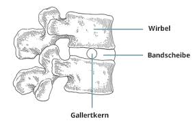 Ein weiteres bekanntes beispiel ist der nucleus pulposus, der gallertkern der bandscheiben, der deshalb große teile des körpergewichts tragen kann. Gesund Schlafen Rucken Und Wirbelsaule Lonsberg
