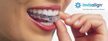 How to get whiter teeth with braces fast. Does Invisalign Work Faster Than Braces And Pros And Cons
