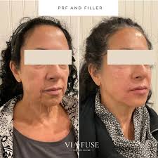 Azalesha Rodriguez DMSc, PA-C