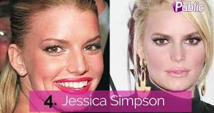 Vidéo : J.Lo, Jenifer, Blake Lively ... Elles ont eu recours à la  rhinoplastie !