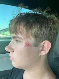 This is my friend's 17 year old nephew, Tanner. Yesterday he was enjoying a  day at Scissortail Park with his mother and younger siblings when he  noticed a person struggling in the