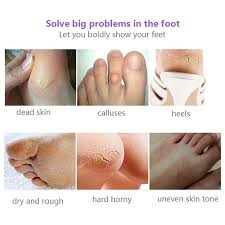Make sure feet are clean, then massage a thick layer of foot cream into the skin. 1 5 Pair Foot Care Peeling Feet Mask Lavender Remove Moisturize Remove Dead Skin Walmart Canada