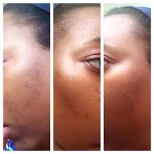 I later stumbled upon reviews on clinique's official website and i was not surprised to see so many negative reviews. Updated Review On Clinique Dark Spot Corrector W Photos Makeuglam