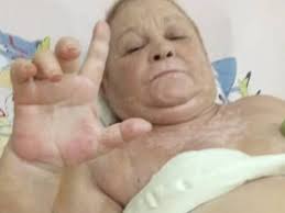 Piden ayuda para activista cubana Mireya Jiménez, operada cáncer de mama