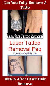 Astanza Tattoo Removal Erase Tattoo Removal Tattoo Removal Worth It Removable Tattoo Ink Alternative Tattoo Rem Laser Tattoo Tattoo Removal Cost Tattoo Removal