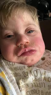 Prayers for successful surgery and recovery