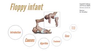 Image result for Floppy Infant