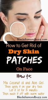 Home Remedies For Dry Skin On Face Remove Dry Skin Flaky Patches On The Face Overnight And Get Soft Skin H Dry Skin Remedies Dry Skin On Face Oil For Dry Skin
