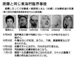 18個政府隱瞞的 核事故真相 廣島出現不能說話的 鱷魚人 照片 saving lives nuclear disasters nuclear reaction