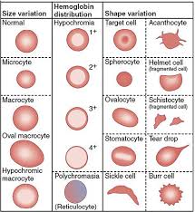 Image result for Peripheral Smear