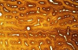 We can see there are two layers of compact bone here. What S Inside A Dinosaur Bone Page 2