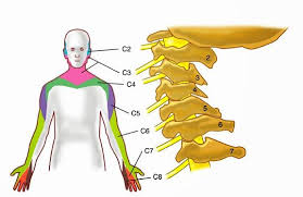 5 Treatments That Help With Cervical Radiculopathies Physicaltherapy Manualtherapy Radiculopathy Physical Therapy Cervical Radiculopathy Exercises