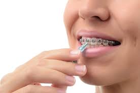 We did not find results for: Prevent Tooth Enamel Problems During Braces With Proper Orthodontic Care Belmar Orthodontics