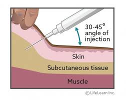 The right dosage of penicillin depends on different factors such as the weight, body type, severity of the condition and the exact treatment used. Giving Injections To Cats Vca Animal Hospital
