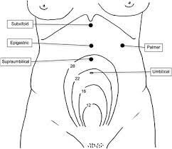 Andrea tinelli, the direct optical access: Closed Entry Technique For The Laparoscopic Management Of Adnexal Mass During Pregnancy Gynecological Surgery Full Text