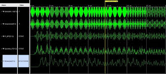 Does the analyzer put a bandpass around a particular frequency and measure the amplitude? Digital Envelope Detection The Good The Bad And The Ugly Rick Lyons