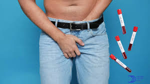 Ardor en el pene - Urólogo Daniel Carrillo