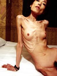 Anorexic Girl (58 photos) - sex and porn
