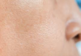7 Dermatologist Approved Tips To Shrink Your Pores – Cleveland Clinic