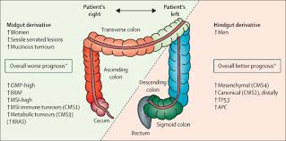 Unfortunately, some colorectal cancers might be present without any signs or symptoms. Colorectal Cancer The Lancet